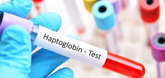 בדיקת הפטוגלובין Haptoglobin - תמונה